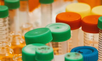 close up of scientific test tubes and plastic bottles used in lab research